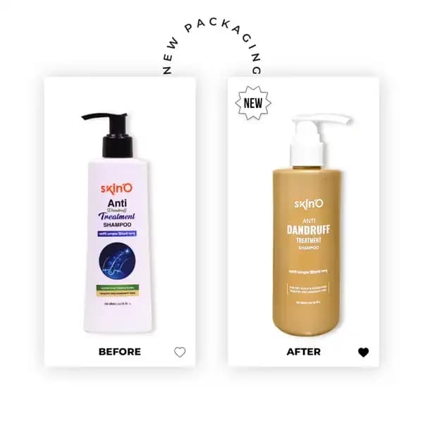 Skino anti dandruff treatment shampoo -200ml