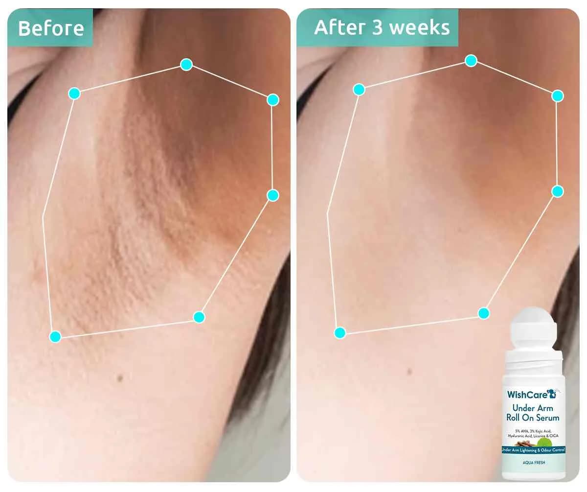 Wishcare Underarm Roll On Serum 50ml